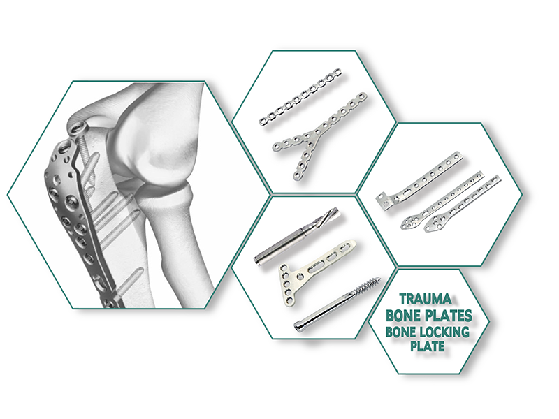 Orthopaedic Nailing System